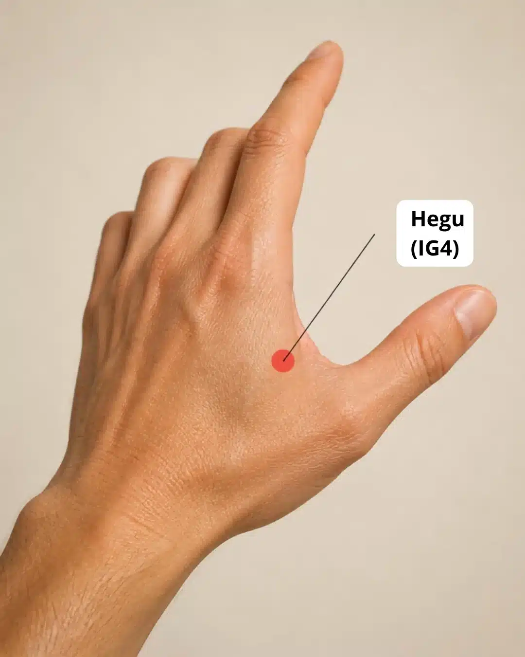 Ubicación del punto de digitopuntura Hegu (IG4) en el dorso de la mano, entre el pulgar y el índice