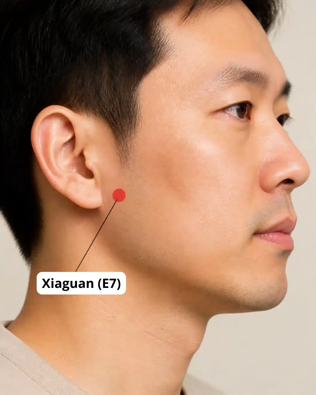 Ubicación del punto de digitopuntura Xiaguan (E7), delante de la oreja